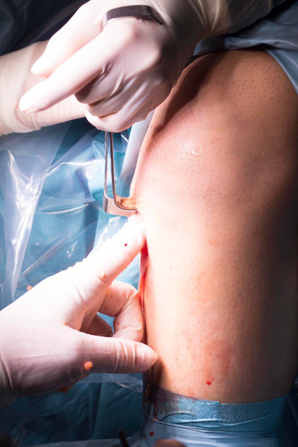  Post-Traumatic Soft Tissue Repair