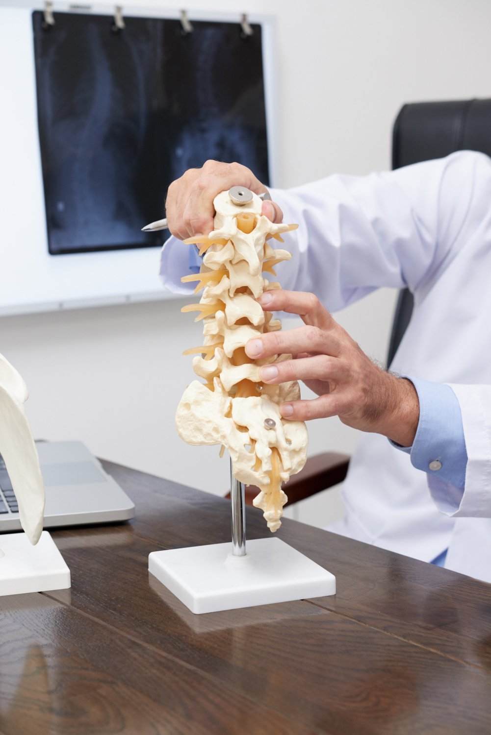 Spinal Deformity Correction 